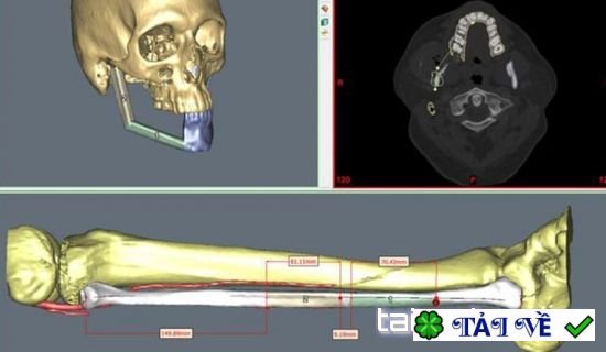 materialise-proplan-cmf-1-1 image