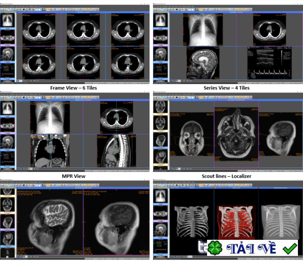 sante-pacs-server-m image