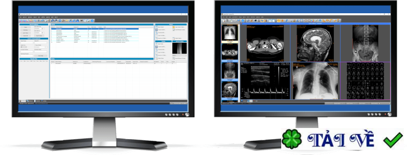 sante-pacs-server-pg image