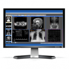 Sante PACS Server PG4 Quản lý ảnh y tế chuẩn DICOM